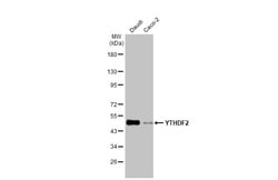 YTHDF2 Recombinant Rabbit Monoclonal Antibody (HL1355), Invitrogen 100 &mu;L | Buy Online | Thermo Scientific | Fisher Scientific