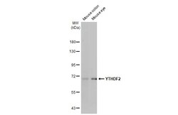 YTHDF2 Recombinant Rabbit Monoclonal Antibody (HL1355), Invitrogen 100 &mu;L | Buy Online | Thermo Scientific | Fisher Scientific