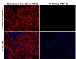 Invitrogen Carbonic Anhydrase IX Recombinant Rabbit Monoclonal Antibody