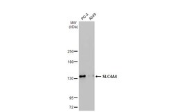 SLC4A4 Recombinant Rabbit Monoclonal Antibody (HL1473), Invitrogen 100 &mu;L | Buy Online | Thermo Scientific | Fisher Scientific