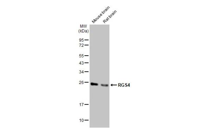RGS4 Monoclonal Antibody (HL1522), Invitrogen 100 μL; Unconjugated ...