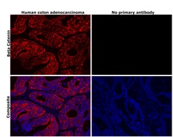 Invitrogen beta Catenin Recombinant Rabbit Monoclonal Antibody (HL1753)