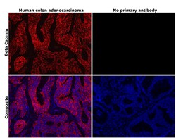 Invitrogen beta Catenin Recombinant Rabbit Monoclonal Antibody (HL1753)