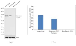Invitrogen beta Catenin Recombinant Rabbit Monoclonal Antibody (HL1753)