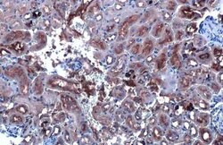 CYP27A1 Recombinant Rabbit Monoclonal Antibody (HL1819), Invitrogen 100