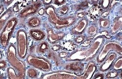 CYP27A1 Recombinant Rabbit Monoclonal Antibody (HL1819), Invitrogen 100