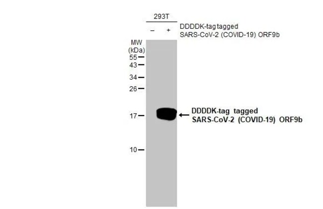 SARS-CoV-2 ORF9b Recombinant Rabbit Monoclonal Antibody (HL1917 ...