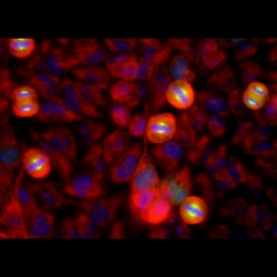 Invitrogen Aurora A Monoclonal Antibody (1A11):Antibodies:Primary Antibodies