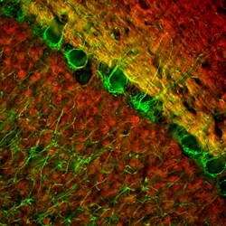 Invitrogen NEFL Monoclonal Antibody (1B11):Antibodies:Primary Antibodies