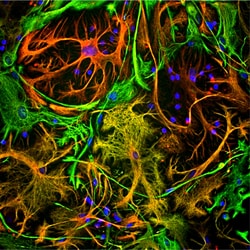 Invitrogen Vimentin Monoclonal Antibody (2A52) 500 &mu;L; Unconjugated:Antibodies,