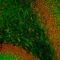 Invitrogen MAP2 Monoclonal Antibody (2C4):Antibodies:Primary Antibodies