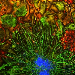 Invitrogen Vimentin Monoclonal Antibody (2D1):Antibodies:Primary Antibodies