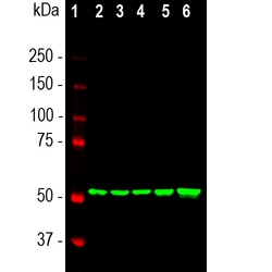 Invitrogen Vimentin Monoclonal Antibody (2D1):Antibodies:Primary Antibodies