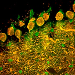 Invitrogen Parvalbumin Monoclonal Antibody (3C9) 500 &mu;L; Unconjugated:Antibodies,