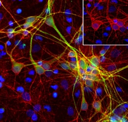 Invitrogen SPTAN1 Monoclonal Antibody (3D7) 100 &mu;L; Unconjugated:Antibodies,