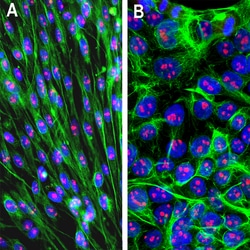 Invitrogen Fibrillarin Monoclonal Antibody (4A4):Antibodies:Primary Antibodies