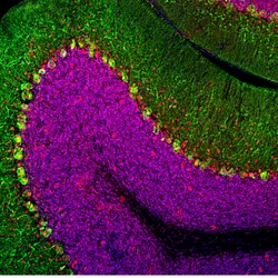 Invitrogen MECP2 Monoclonal Antibody (4F11) 100 &mu;L; Unconjugated:Antibodies,