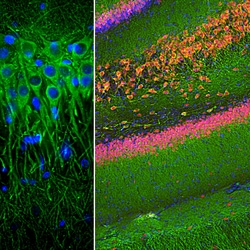 Invitrogen MAP2 Monoclonal Antibody (4H5):Antibodies:Primary Antibodies