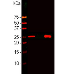 Invitrogen Calbindin D28K Monoclonal Antibody (4H7) 500 &mu;L; Unconjugated:Antibodies,