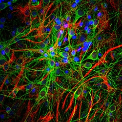 Invitrogen Tau Monoclonal Antibody (5B10) 500 &mu;L; Unconjugated:Antibodies,