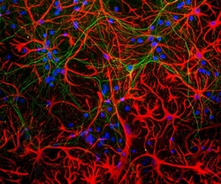 Invitrogen GFAP Monoclonal Antibody (5C10):Antibodies:Primary Antibodies