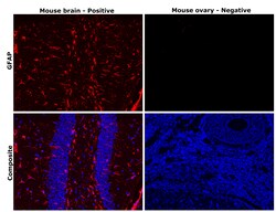 Invitrogen GFAP Monoclonal Antibody (5C10):Antibodies:Primary Antibodies
