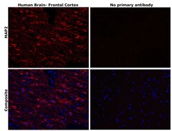 Invitrogen MAP2 Monoclonal Antibody (5H11) 500 &mu;L; Unconjugated:Antibodies,