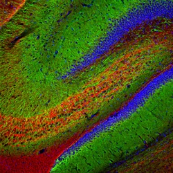 Invitrogen MAP2 Monoclonal Antibody (5H11):Antibodies:Primary Antibodies