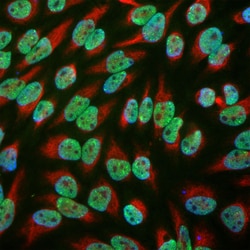Invitrogen EWSR1 Monoclonal Antibody (5H7):Antibodies:Primary Antibodies