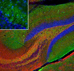 Invitrogen beta Synuclein Monoclonal Antibody (6A10):Antibodies:Primary