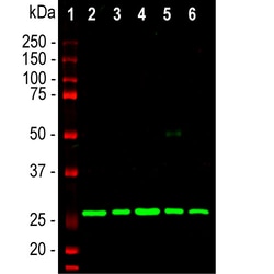 Invitrogen Calretinin Monoclonal Antibody (6A9) 500 &mu;L; Unconjugated:Antibodies,