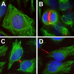 Invitrogen Aurora B Monoclonal Antibody (6G2) 100 &mu;L; Unconjugated:Antibodies,