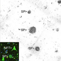 Invitrogen beta Amyloid Monoclonal Antibody (AB9) 500 &mu;L; Unconjugated:Antibodies,