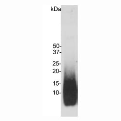 Invitrogen beta Amyloid Monoclonal Antibody (AB9) 500 &mu;L; Unconjugated:Antibodies,