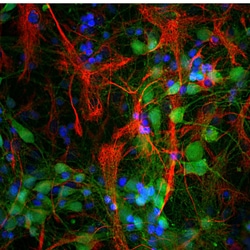Invitrogen PGP9.5 Monoclonal Antibody (BH7):Antibodies:Primary Antibodies
