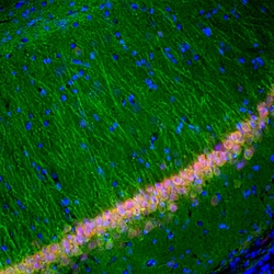 Invitrogen PGP9.5 Monoclonal Antibody (BH7):Antibodies:Primary Antibodies