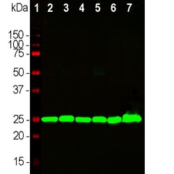 Invitrogen PGP9.5 Monoclonal Antibody (BH7):Antibodies:Primary Antibodies
