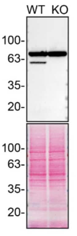 Invitrogen EPHX2 Recombinant Rabbit Monoclonal Antibody (JE64-07) 100 &mu;L | Buy Online | Invitrogen&trade; | Fisher Scientific