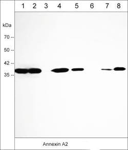 Invitrogen Annexin A2 Monoclonal Antibody (M009) 100 &mu;L; Unconjugated:Antibodies,