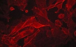 Invitrogen AXL Monoclonal Antibody (M047) 100 &mu;L; Unconjugated:Antibodies,