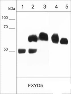 Invitrogen Dysadherin Monoclonal Antibody (M029) 100 &mu;L; Unconjugated:Antibodies,