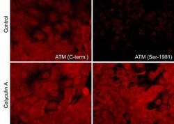 Invitrogen ATM Monoclonal Antibody (M361) 100 &mu;L; Unconjugated:Antibodies,