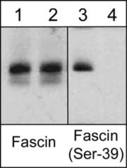 Invitrogen Fascin Monoclonal Antibody (55K2) 100 &mu;L | Buy Online | Invitrogen&trade; | Fisher Scientific