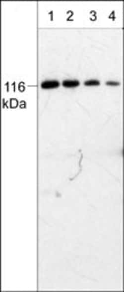 Invitrogen PYK2 Monoclonal Antibody (M229) 100 &mu;L; Unconjugated:Antibodies,