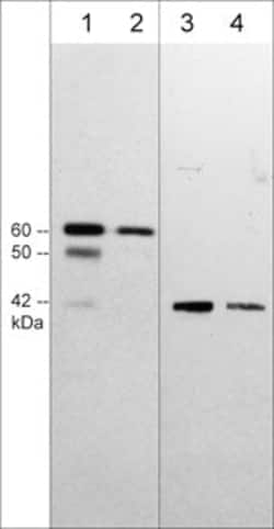 Invitrogen SPHK1 Monoclonal Antibody (M540) 100 &mu;L; Unconjugated:Antibodies,