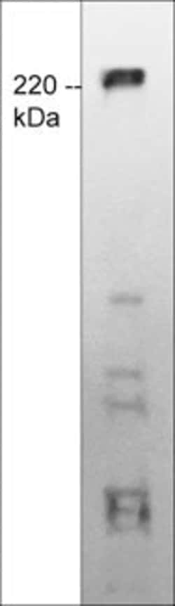 Invitrogen TRPM7 Monoclonal Antibody (M573) 100 &mu;L; Unconjugated:Antibodies,