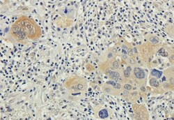 Invitrogen Bax Chimeric Recombinant Rabbit Monoclonal Antibody (6A7) 200