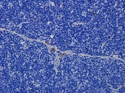 Invitrogen CD52 Chimeric Recombinant Human Monoclonal Antibody (Campath-1H)