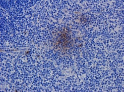 Invitrogen CD52 Chimeric Recombinant Human Monoclonal Antibody (Campath-1H)