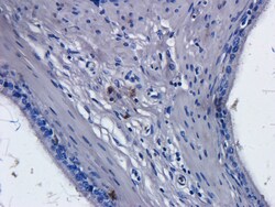 Invitrogen CD52 Chimeric Recombinant Human Monoclonal Antibody (Campath-1H)